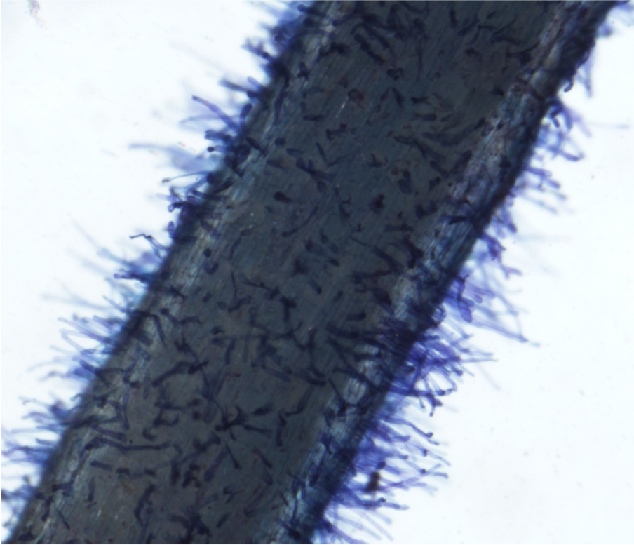 Microscope Hair Root - Micropedia