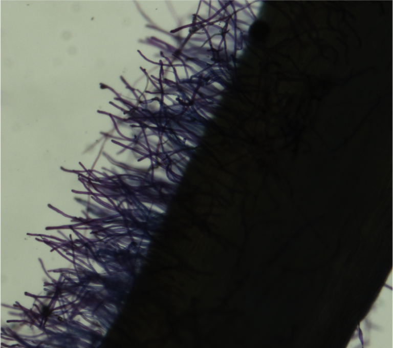 Focus microscope on root edge for measuring root hair length