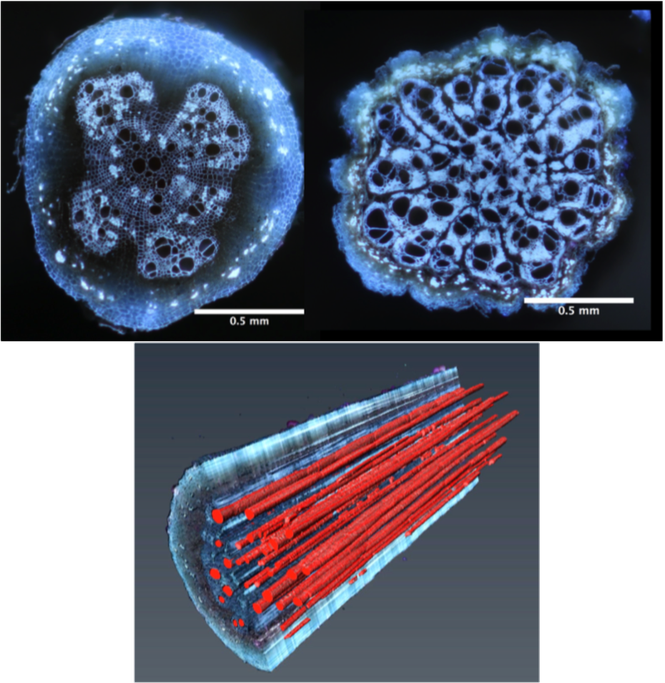 Metaxylem variation in common bean