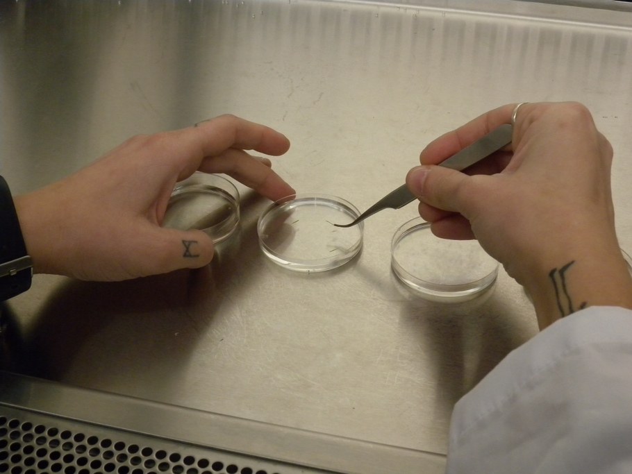 Transfer the tissues from bleach to the first dish with water and wash them for 30 seconds. 